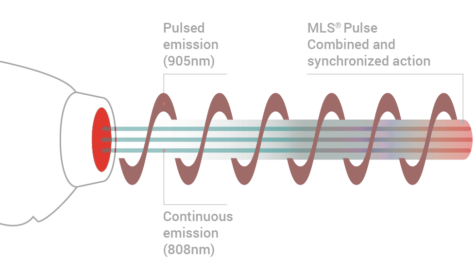 ASA Laser MLS M6