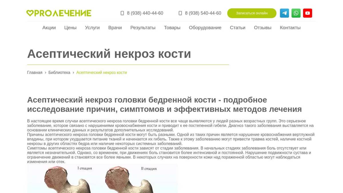 Асептический некроз кости: лечение в Сочи, запись на прием, стоимость ...