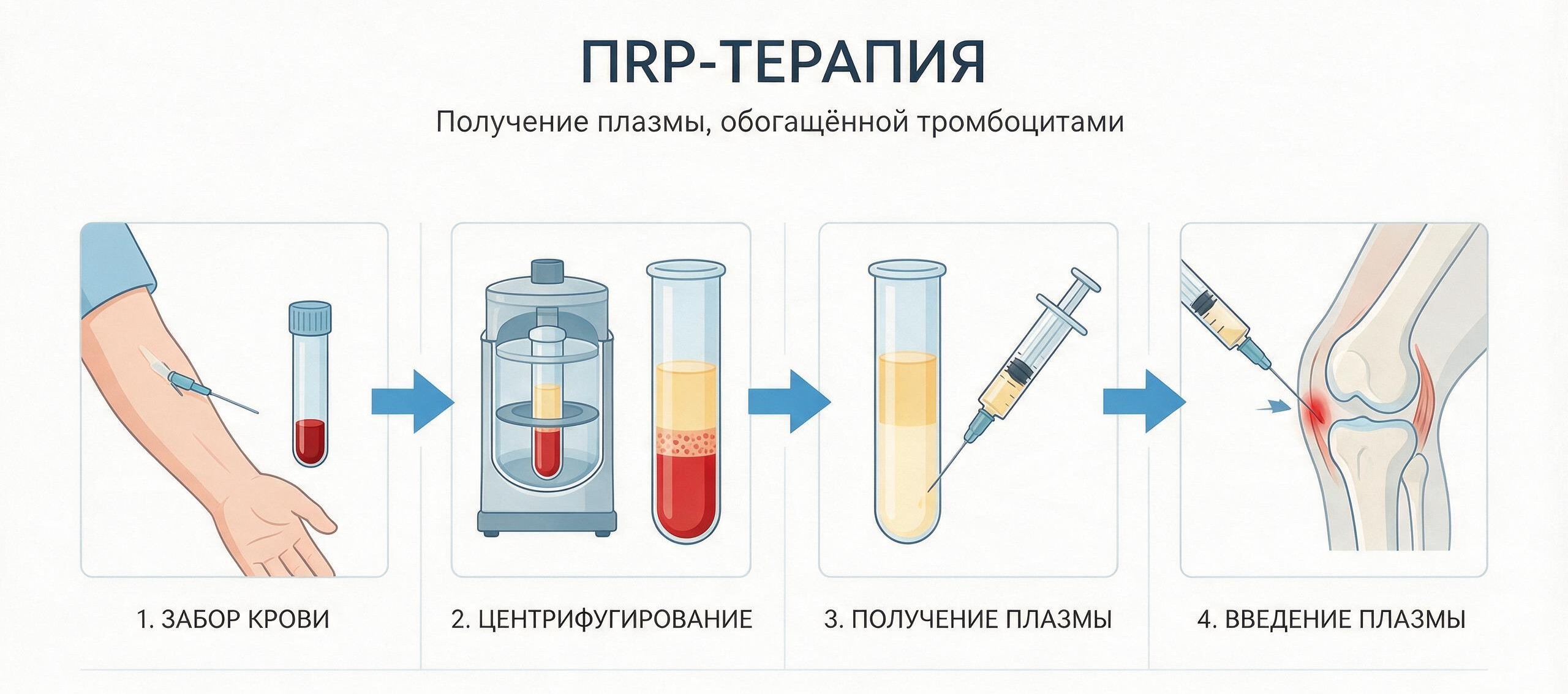 Плазмотерапия в клинике Пролечение в Сочи